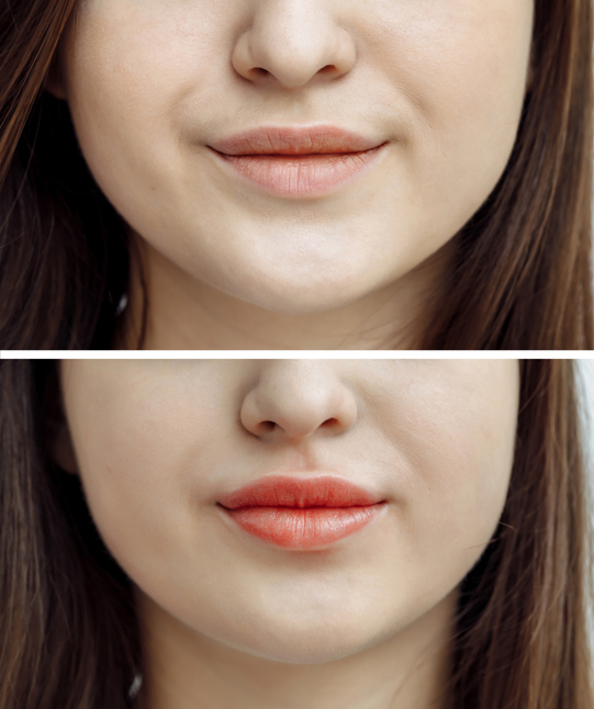 Photo comparison before and after permanent makeup, tattooing of lips